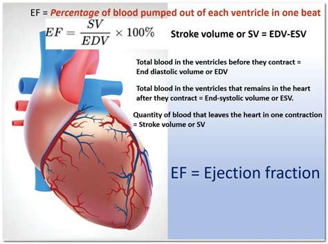 ejection fraction stress test.